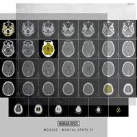 Mental State EP