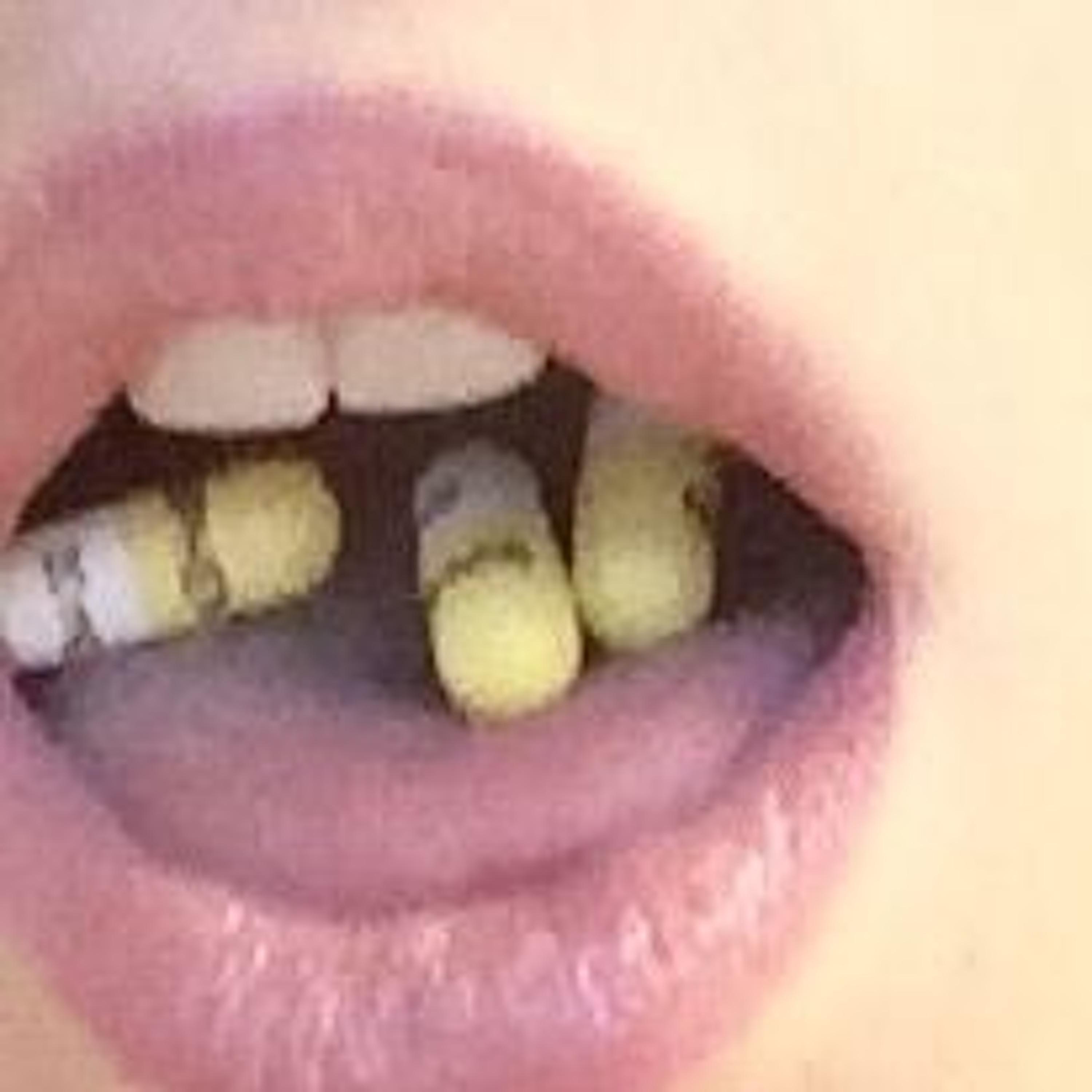 DRUGZ IN MY SYSTEM (feat. asht0nn & suddendeathovertime)