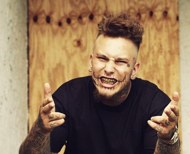 Stitches