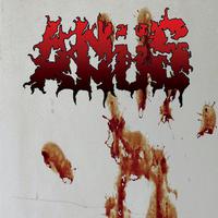 Anüs