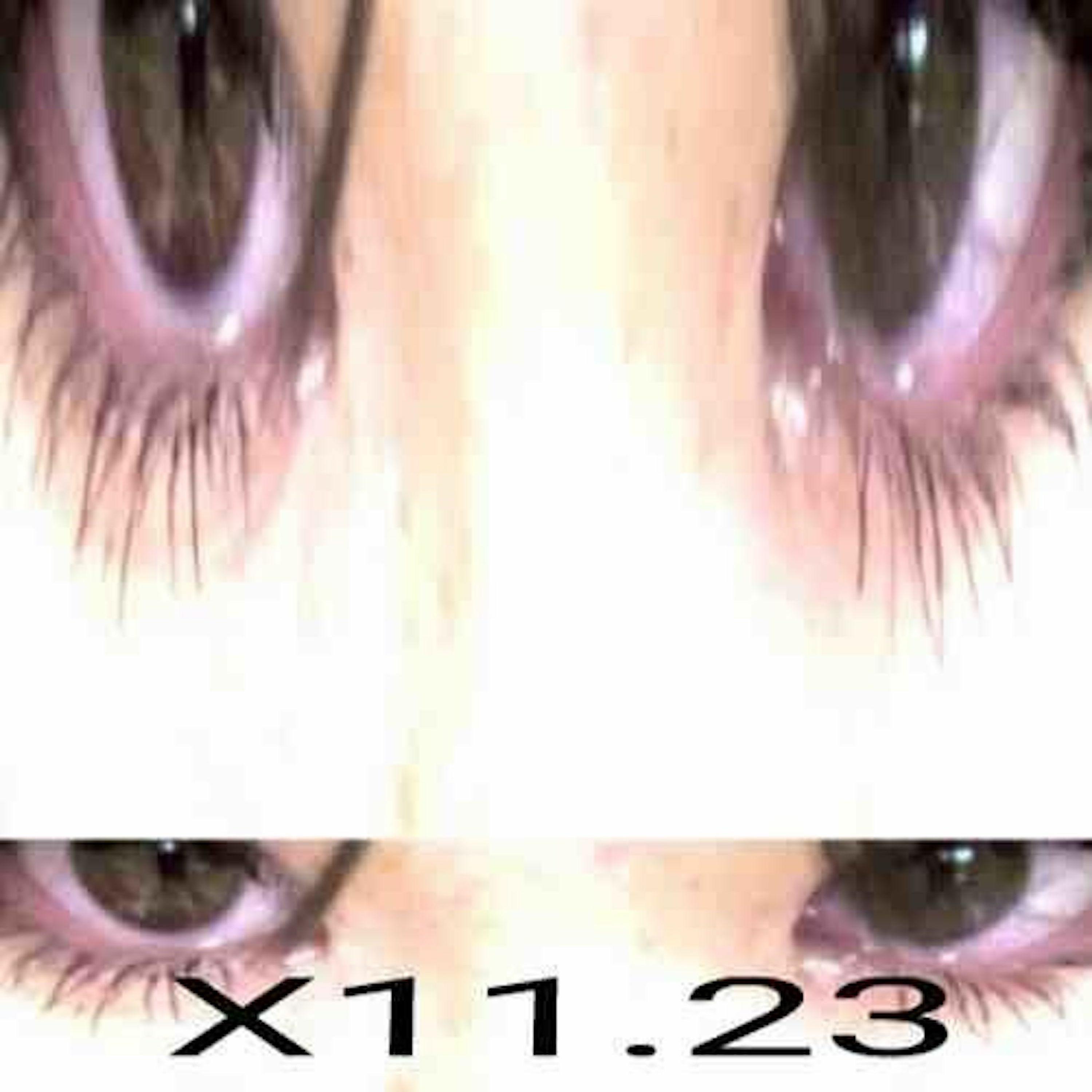 song-img
