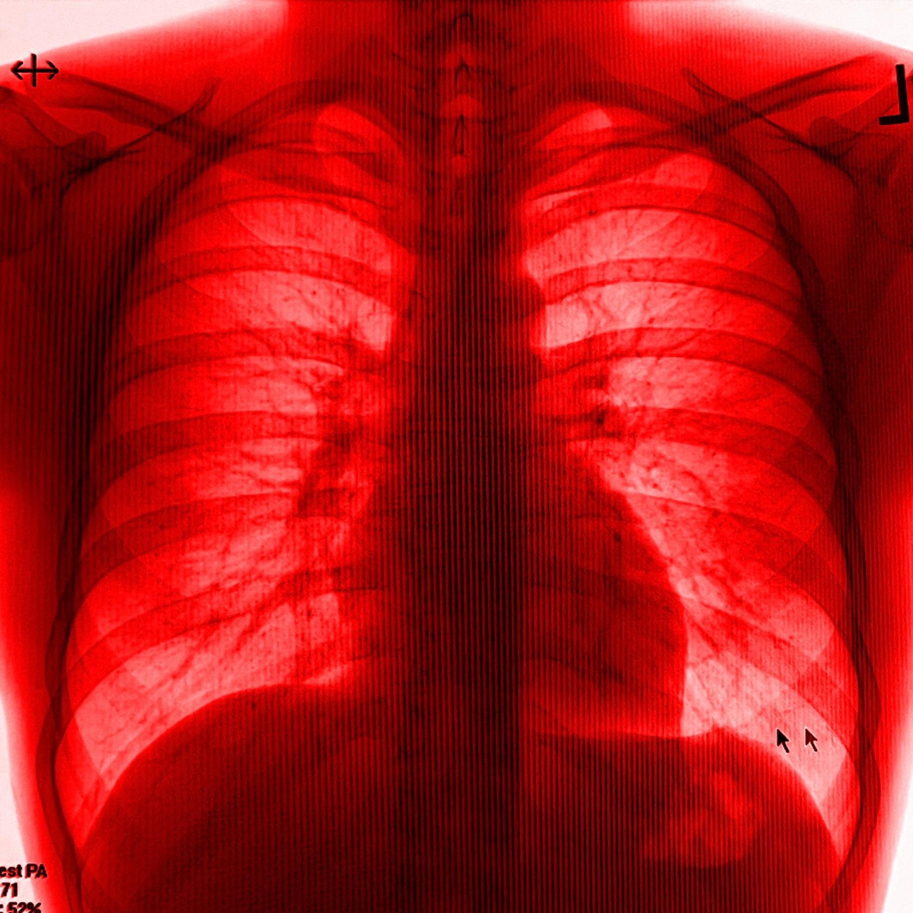 KSUBI JEAN ROCKSTAR (feat. agonyTrey., WAD3, SSDrizzyX4 & Jastyn)