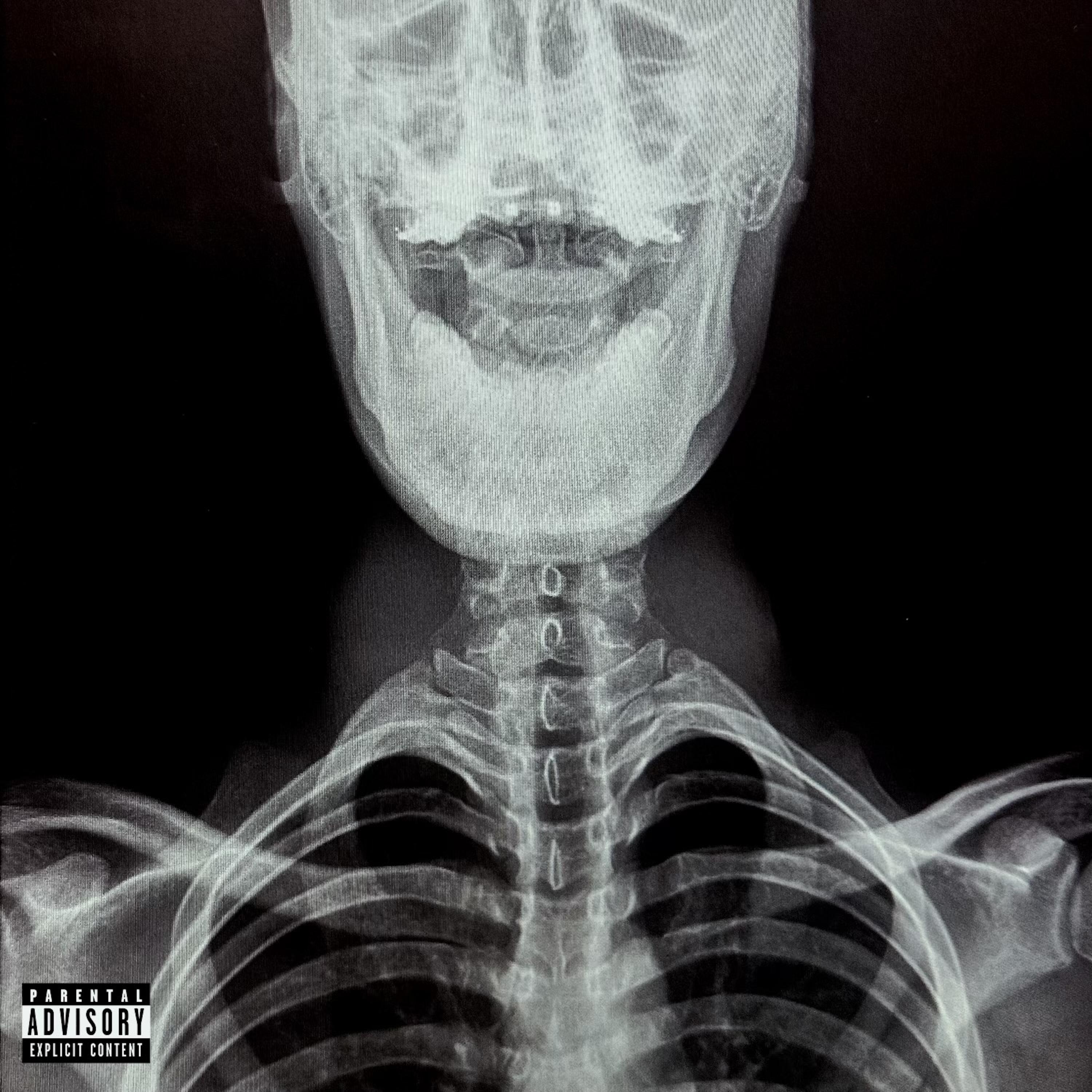 Speed (feat. IsoBkae)