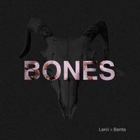 Bones