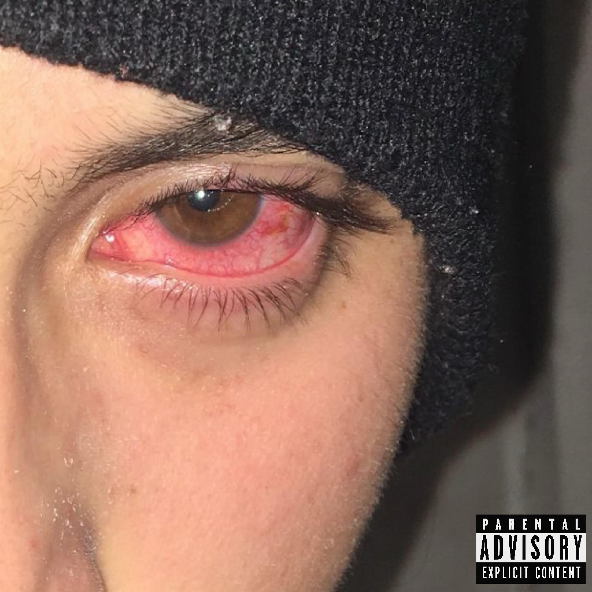 99