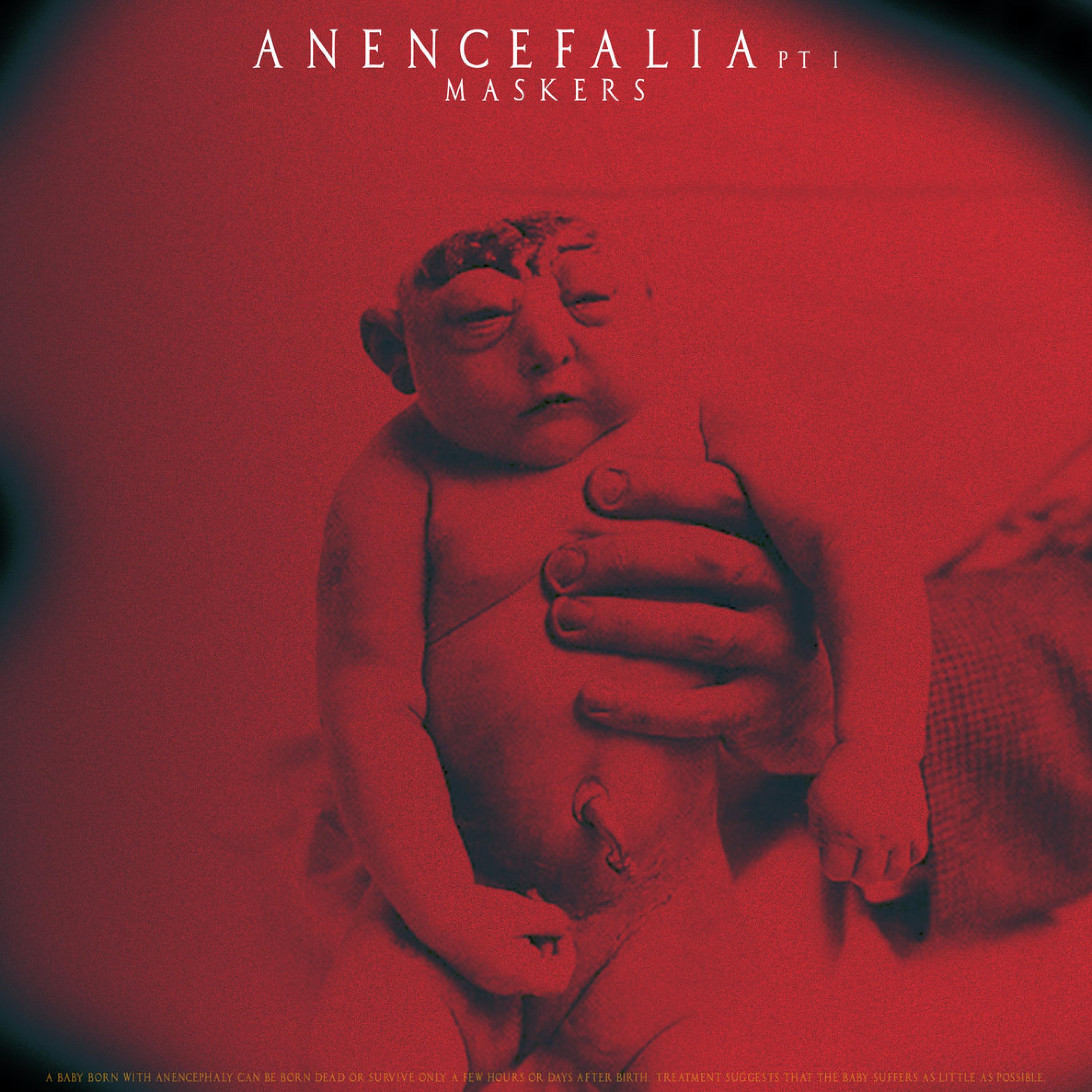 Paroxysm Anencefalia