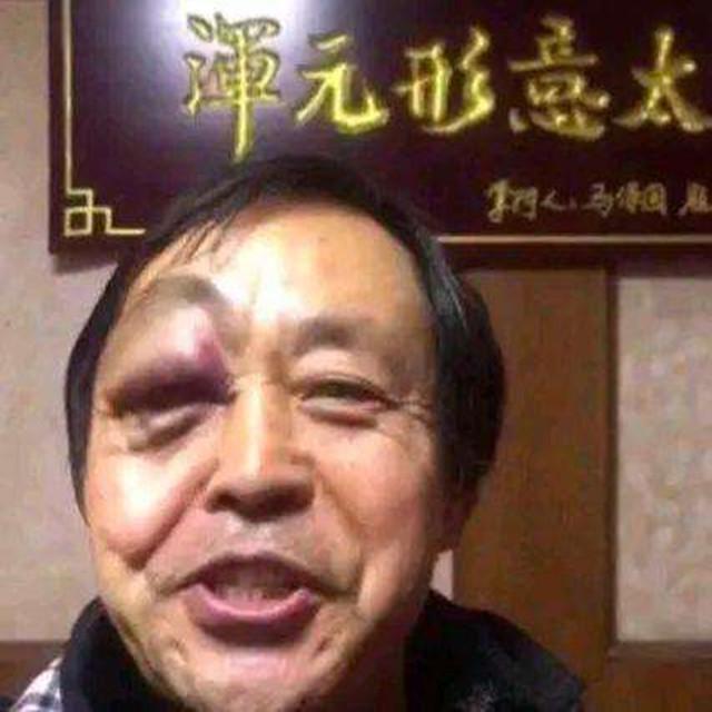 不讲武德，接！化！发！