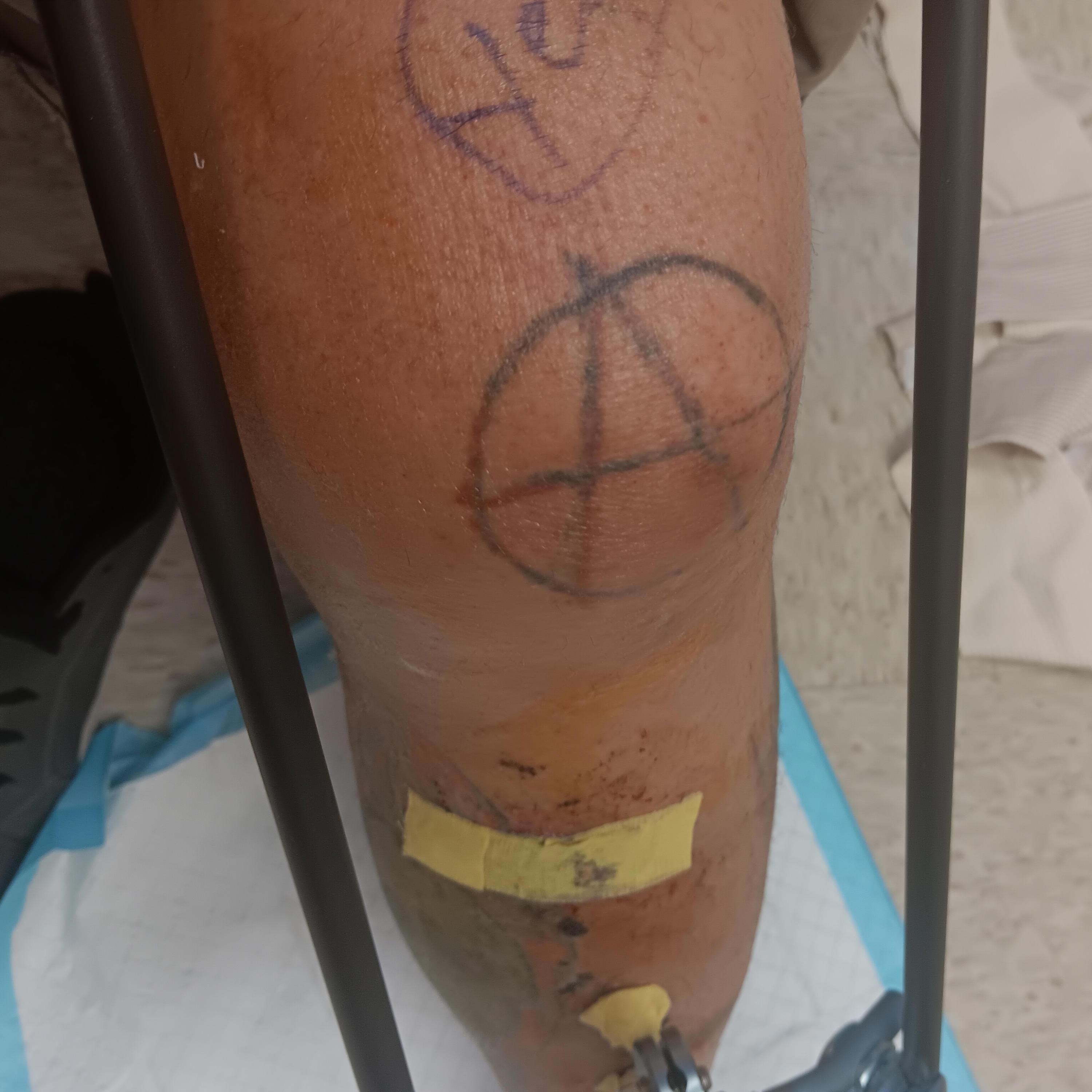 Visit from prescot valley (Radio Edit)