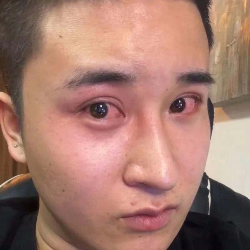 还我妈生鼻封面