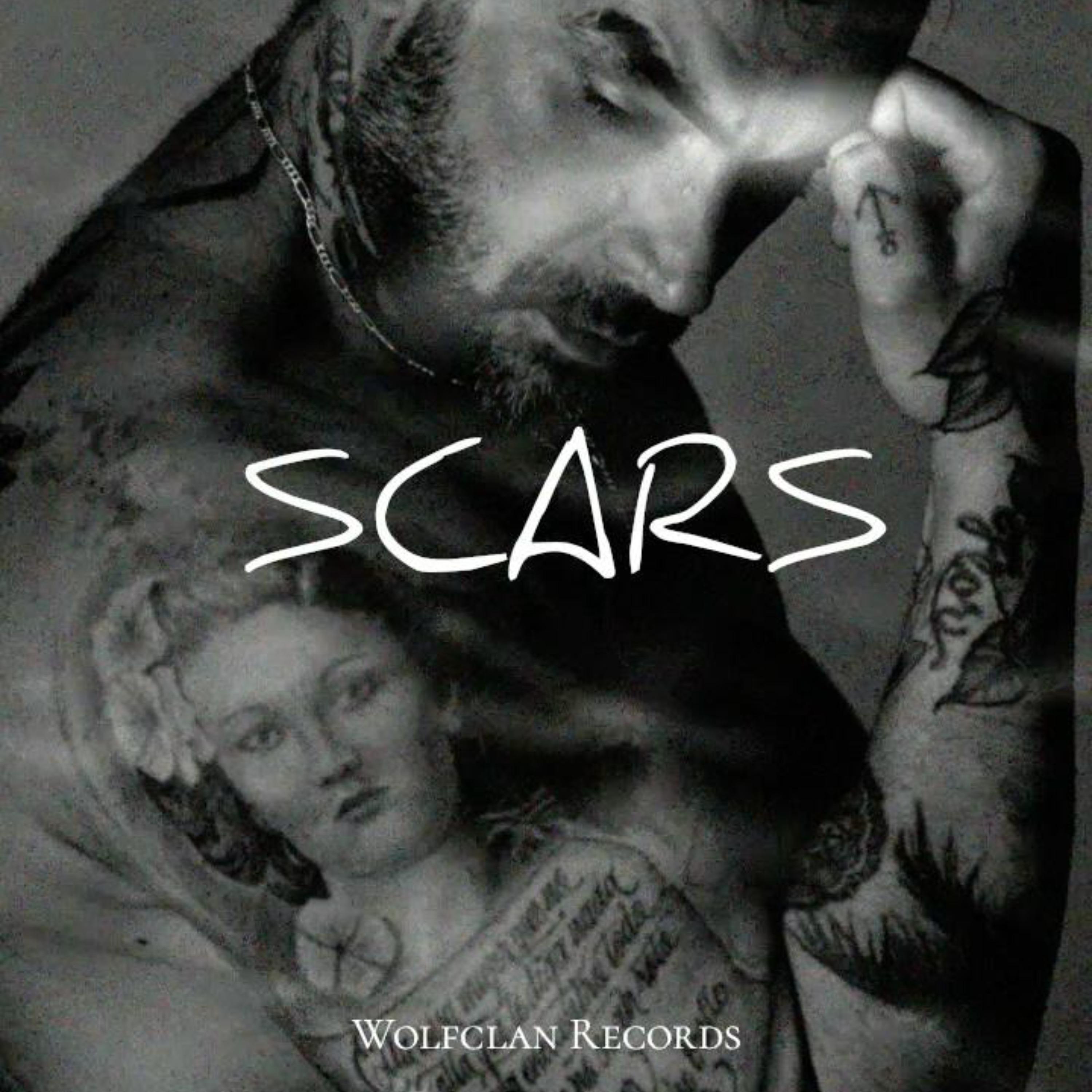 Scars