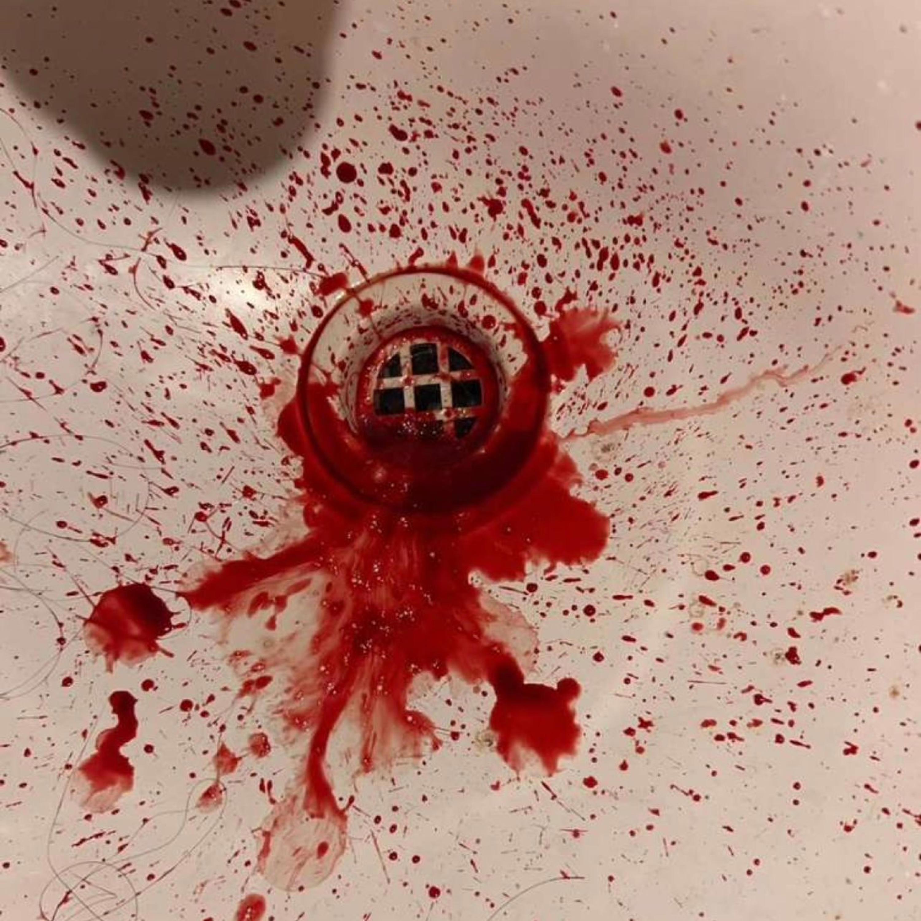 open ur eyes bitch i love u