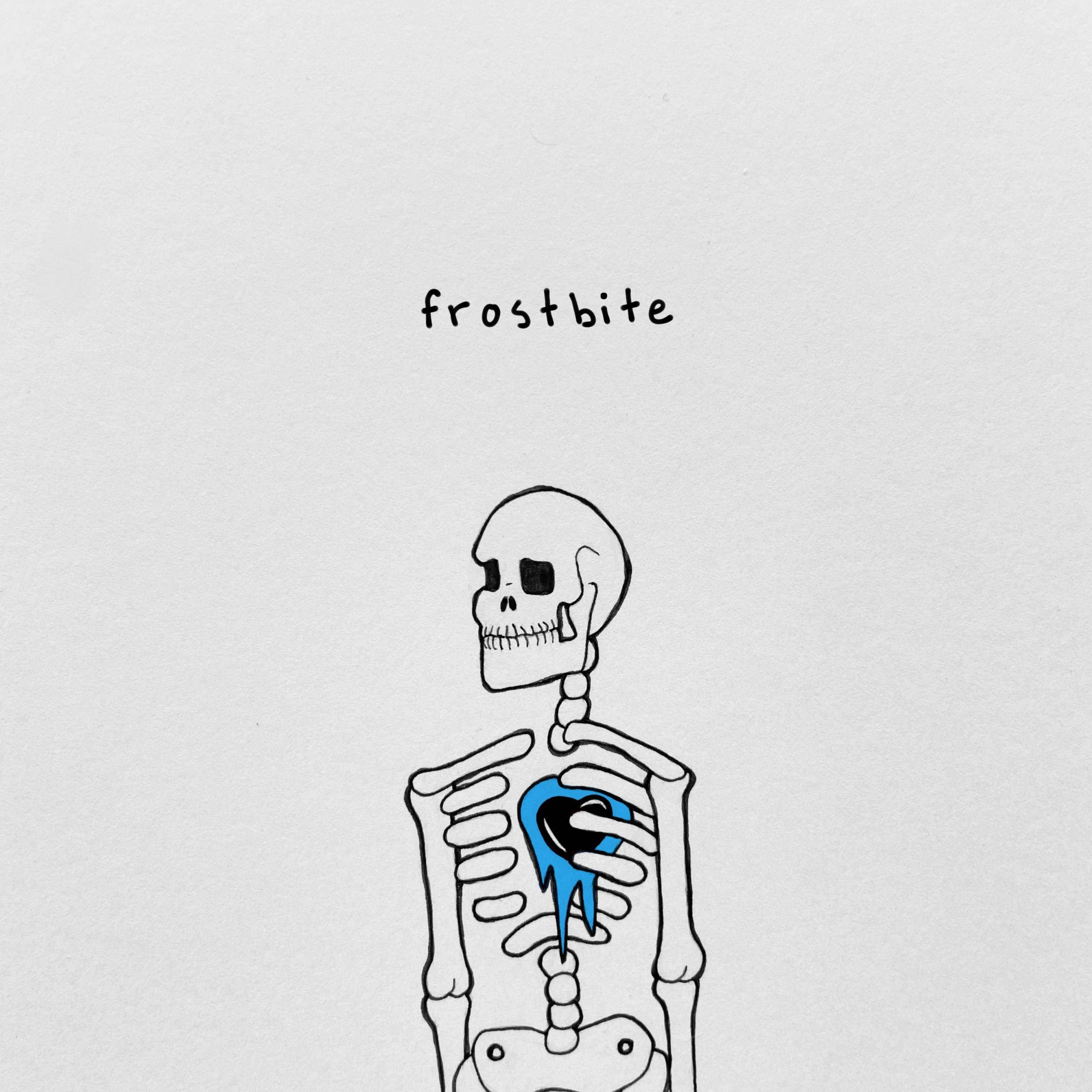 frostbite