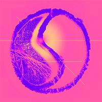 Vitruvian (Edit)