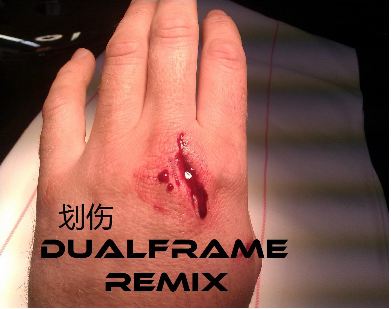 划伤 (DualFrame Remix)专辑