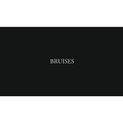 Bruises（翻自 Chairlift）