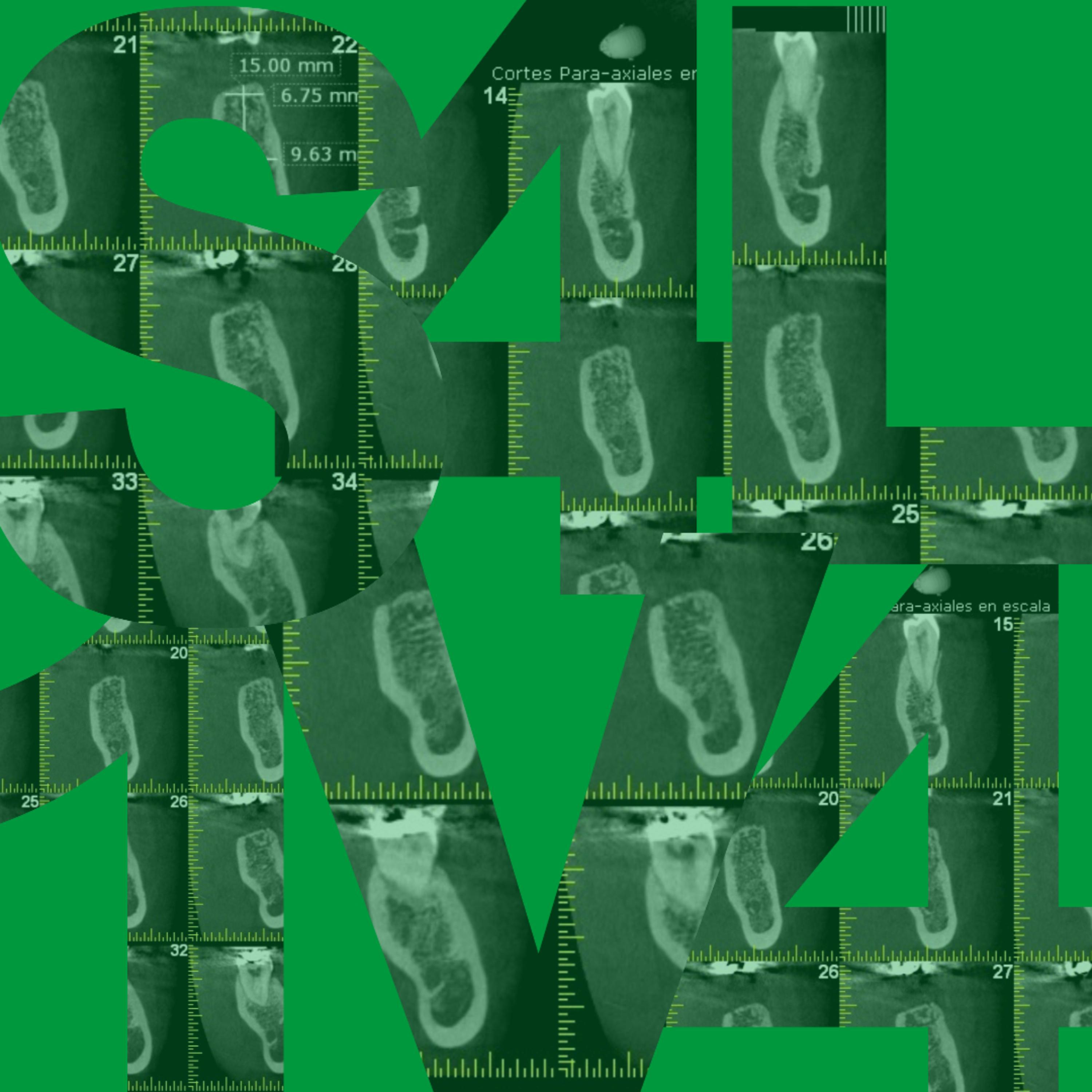 Saliva