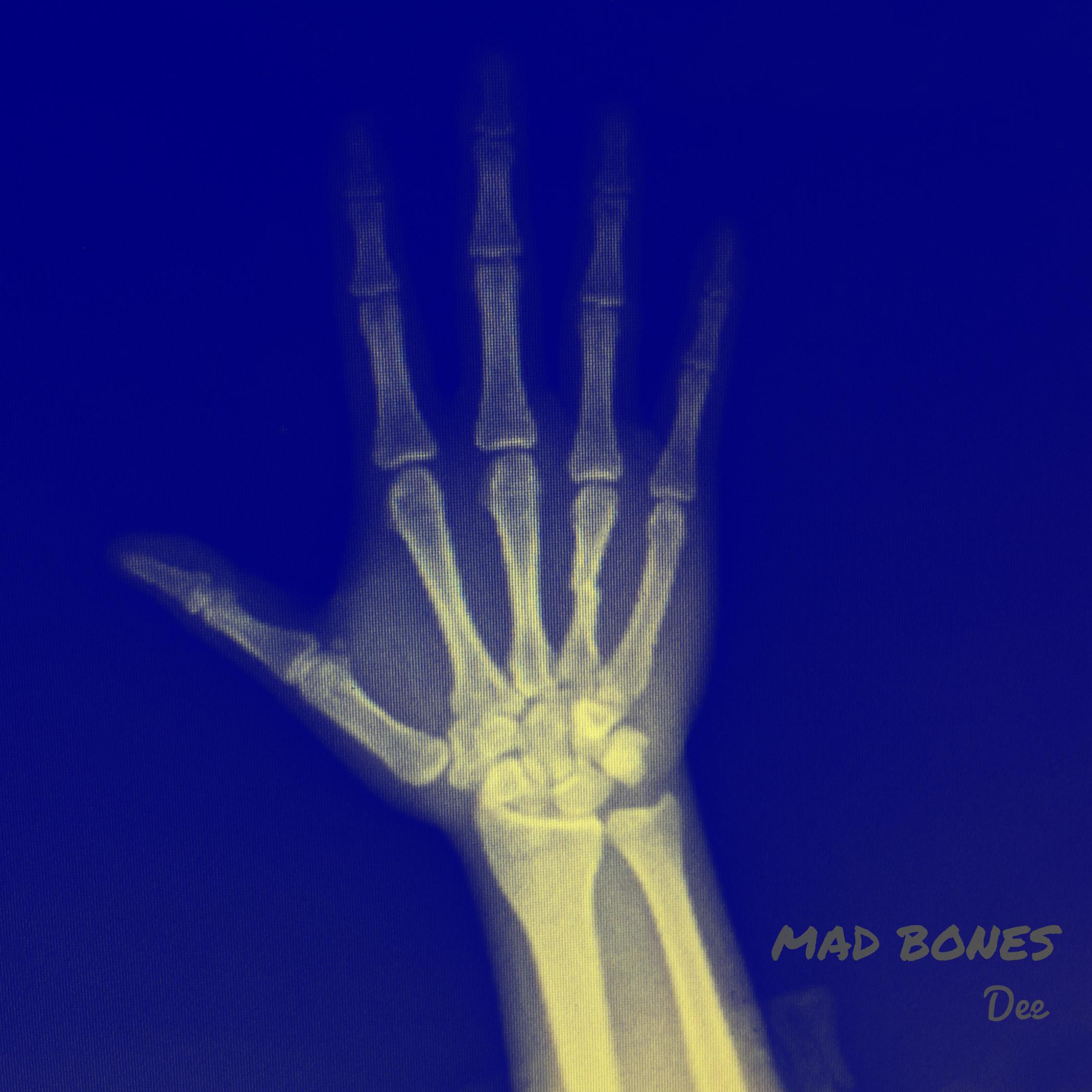 Mad Bones专辑