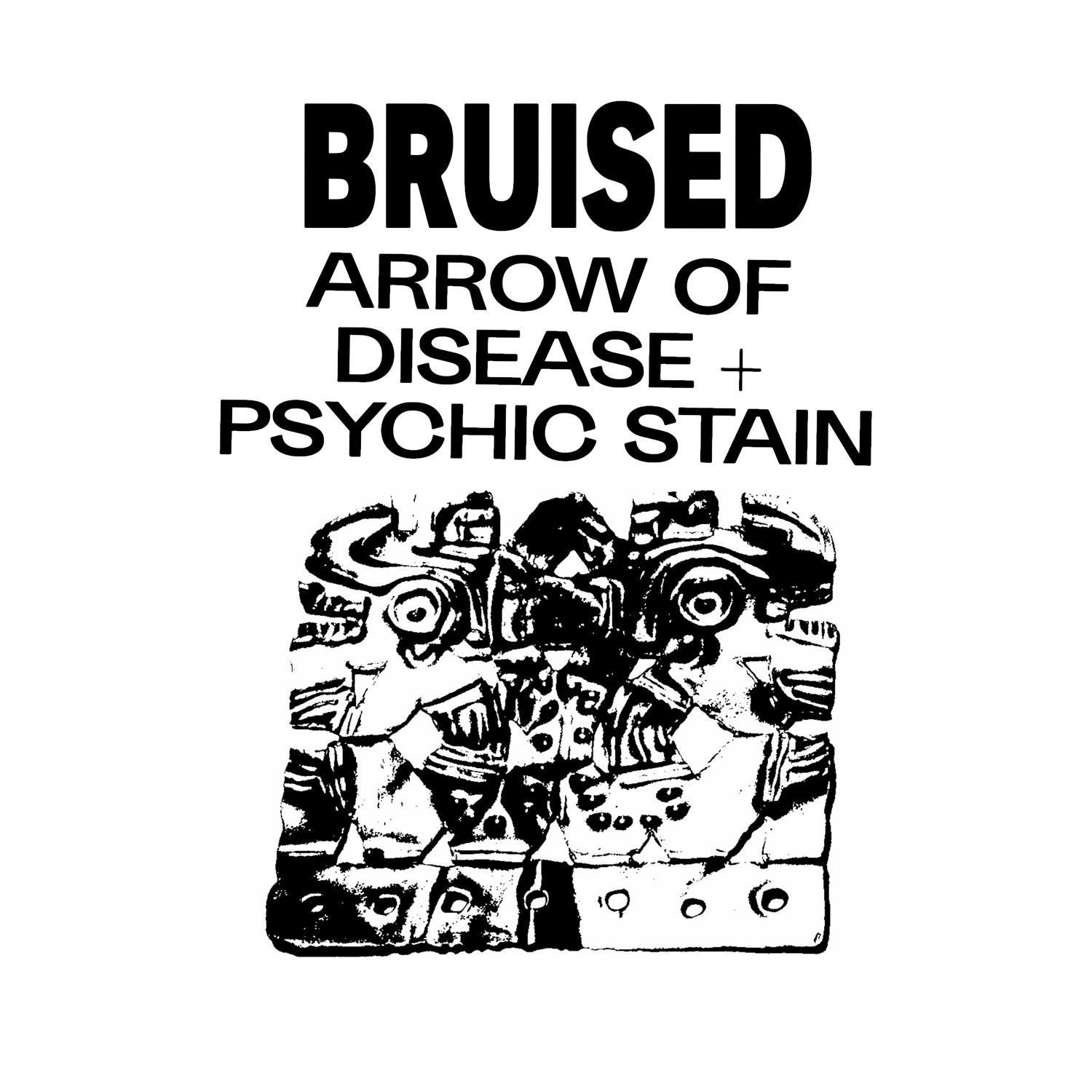 Arrow of Disease