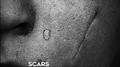 Scars (Thimlife Remix)专辑