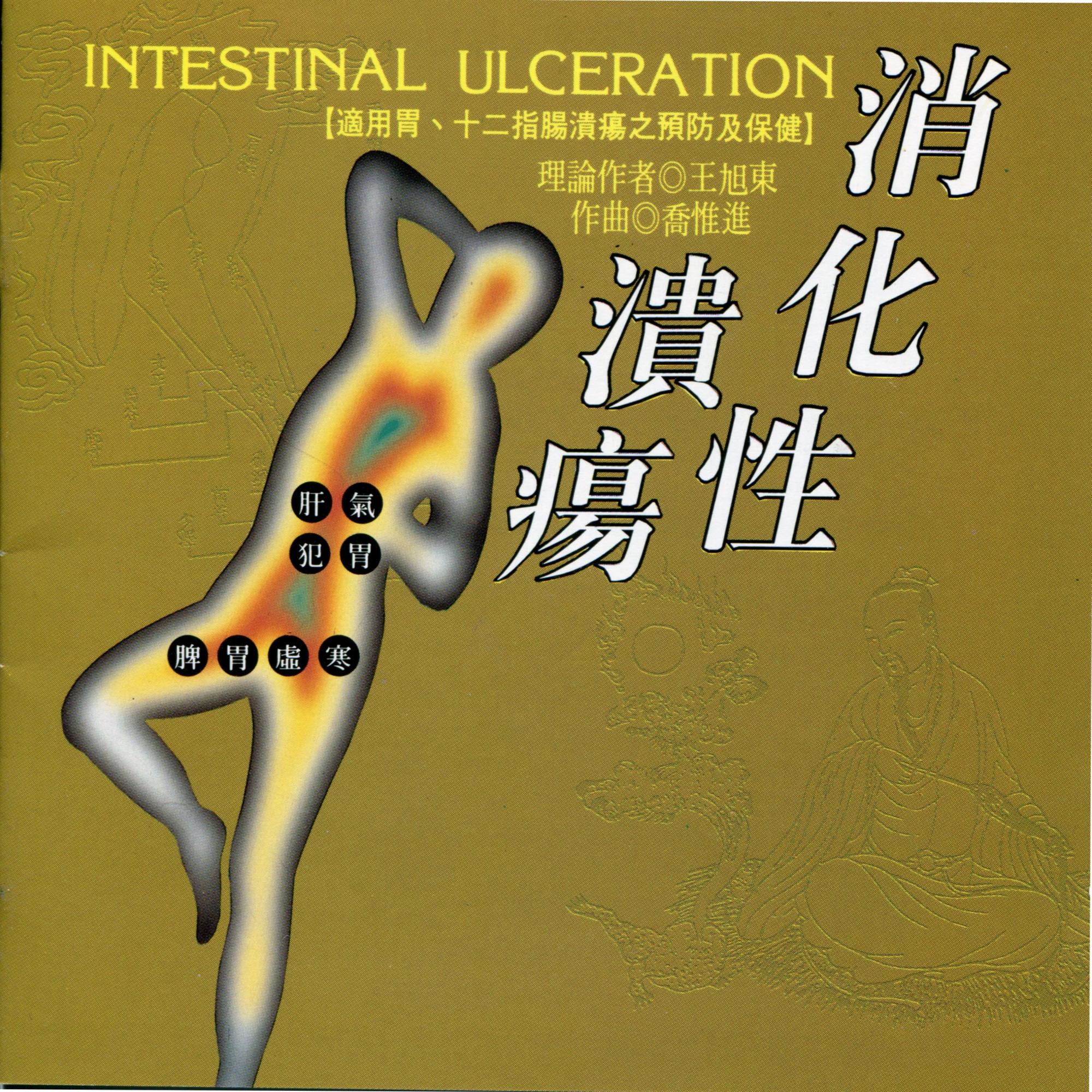消化性溃疡