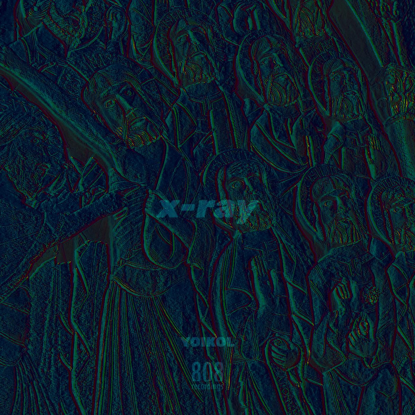 X-Ray