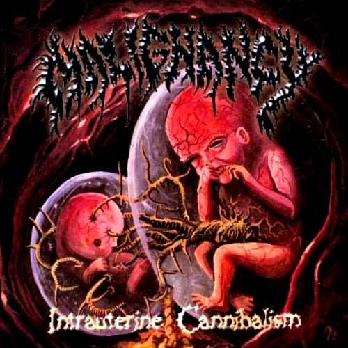 Intrauterine Cannibalism