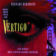 Vertigo