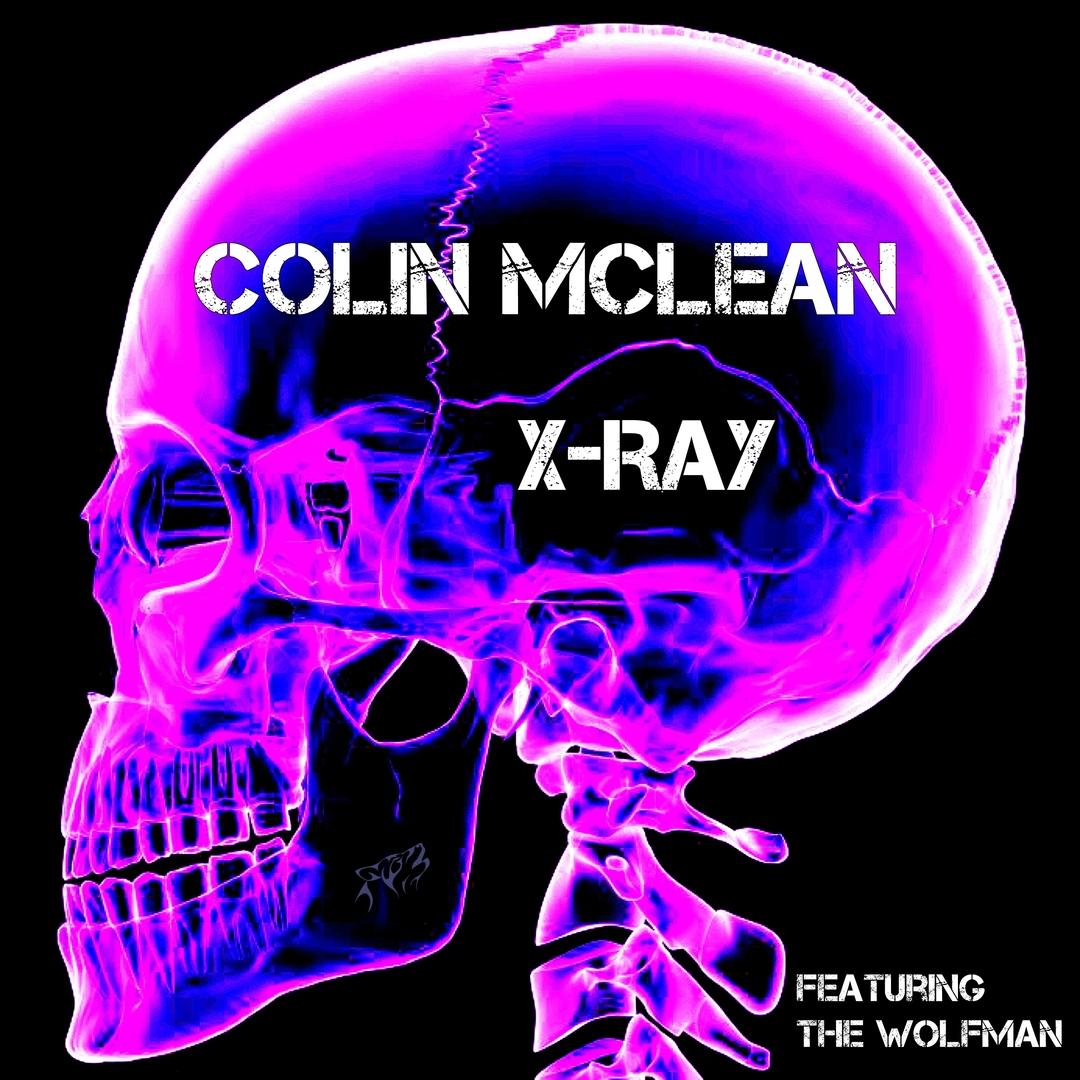 X-Ray