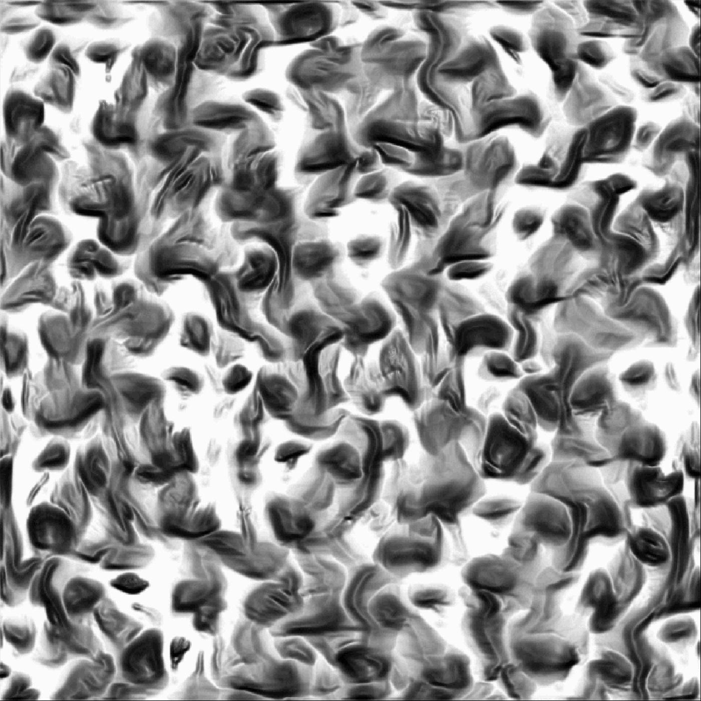 Dent