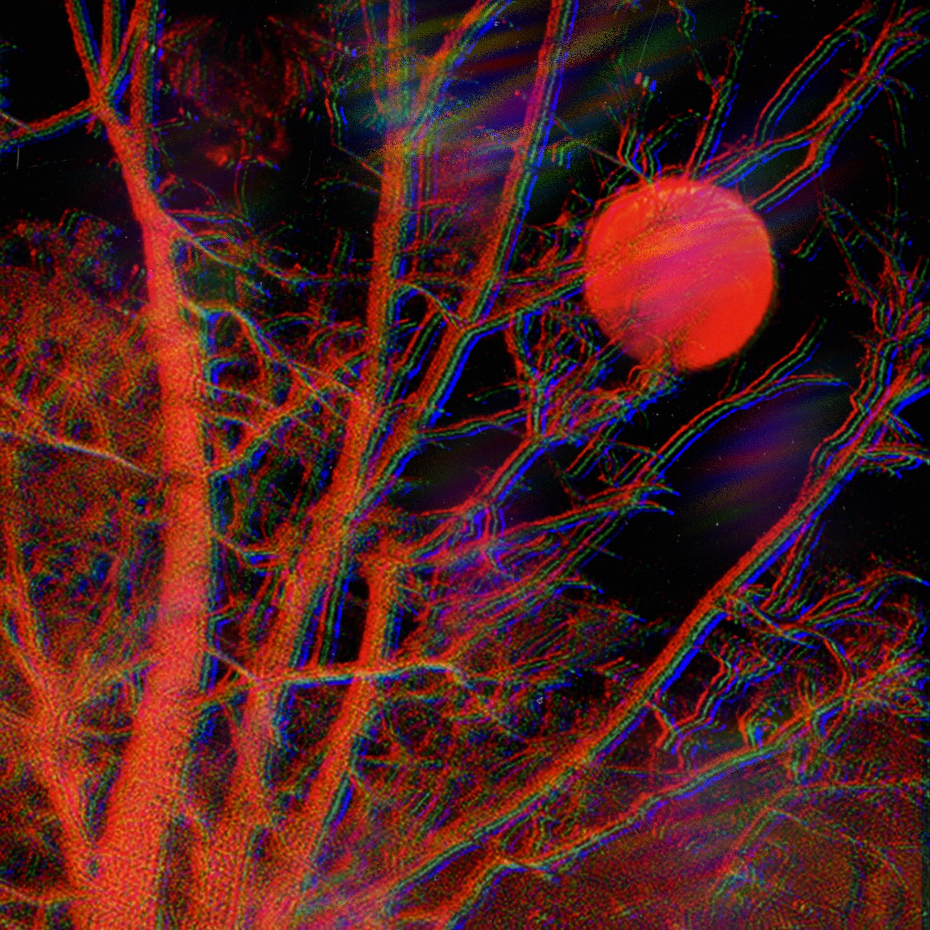 HYPOTHERMIA (feat. eddison)