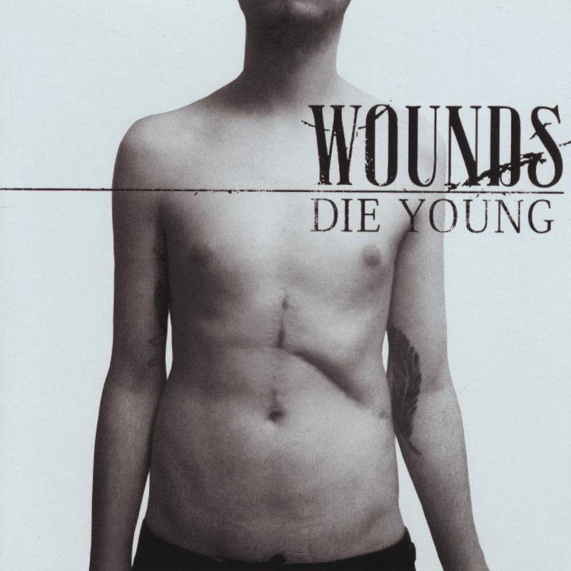 Wounds - Dead Dead ****ing Dead