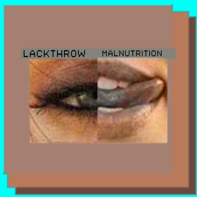 malnutrition