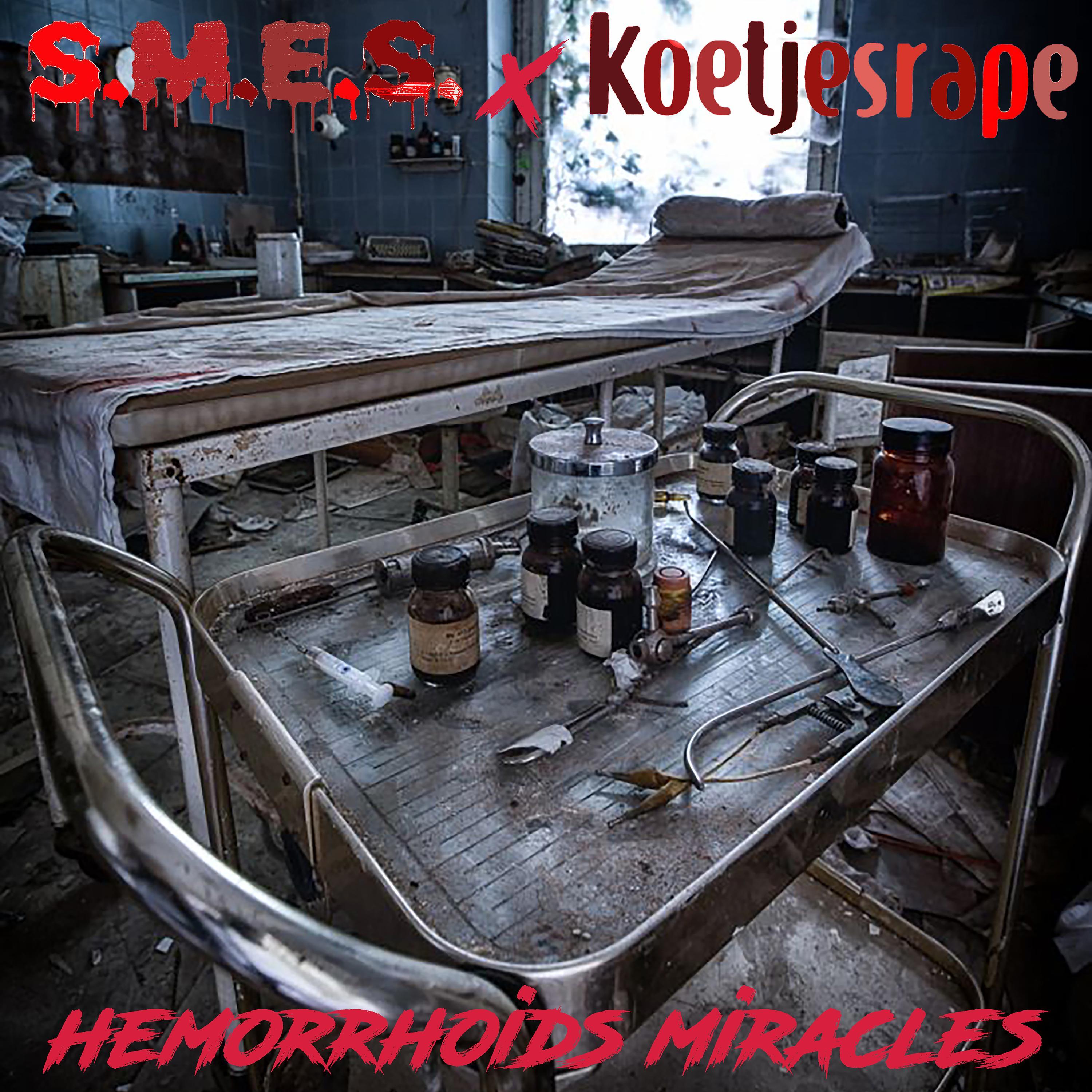 Hemorrhoids Miracles