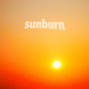 Sunburn
