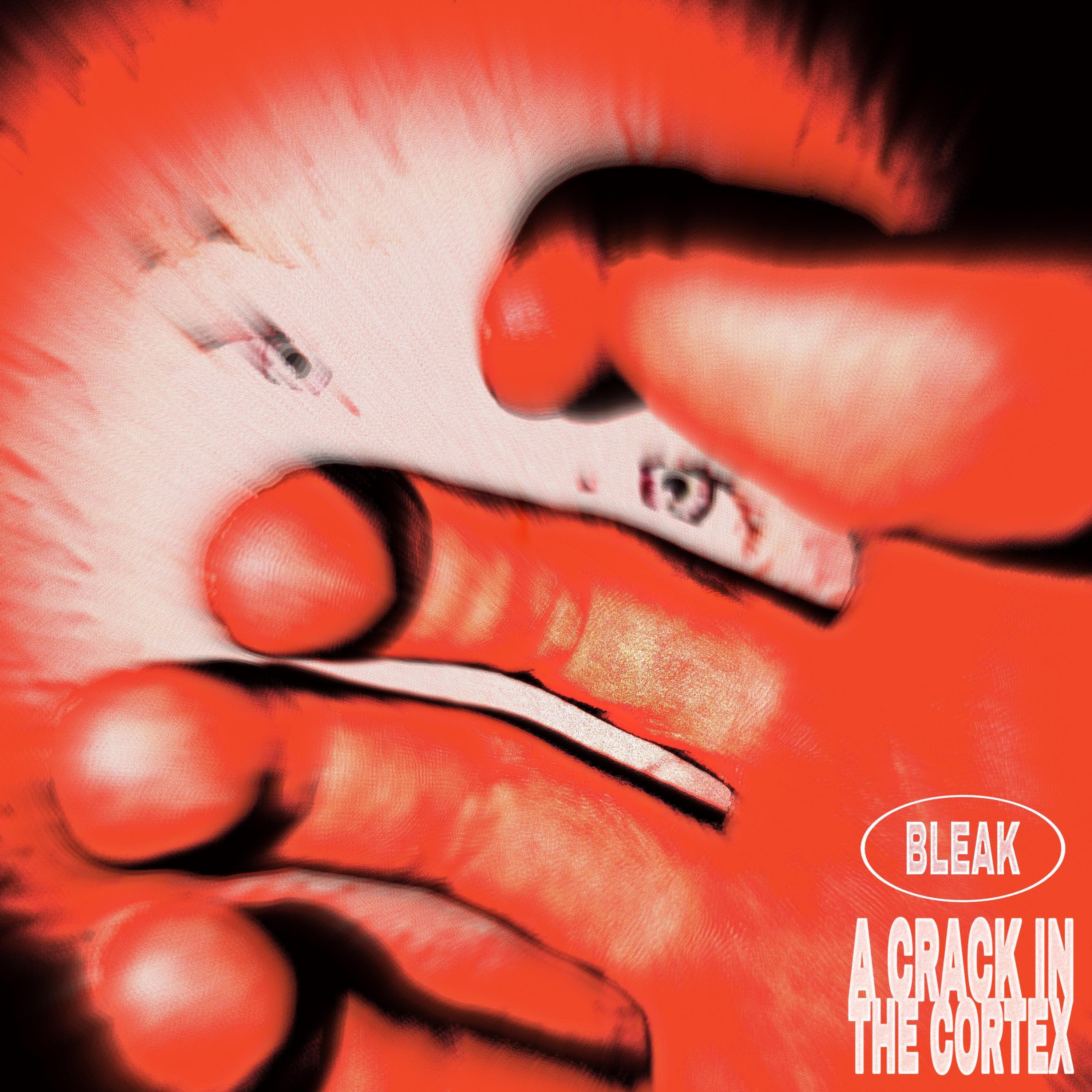 A Crack in the Cortex