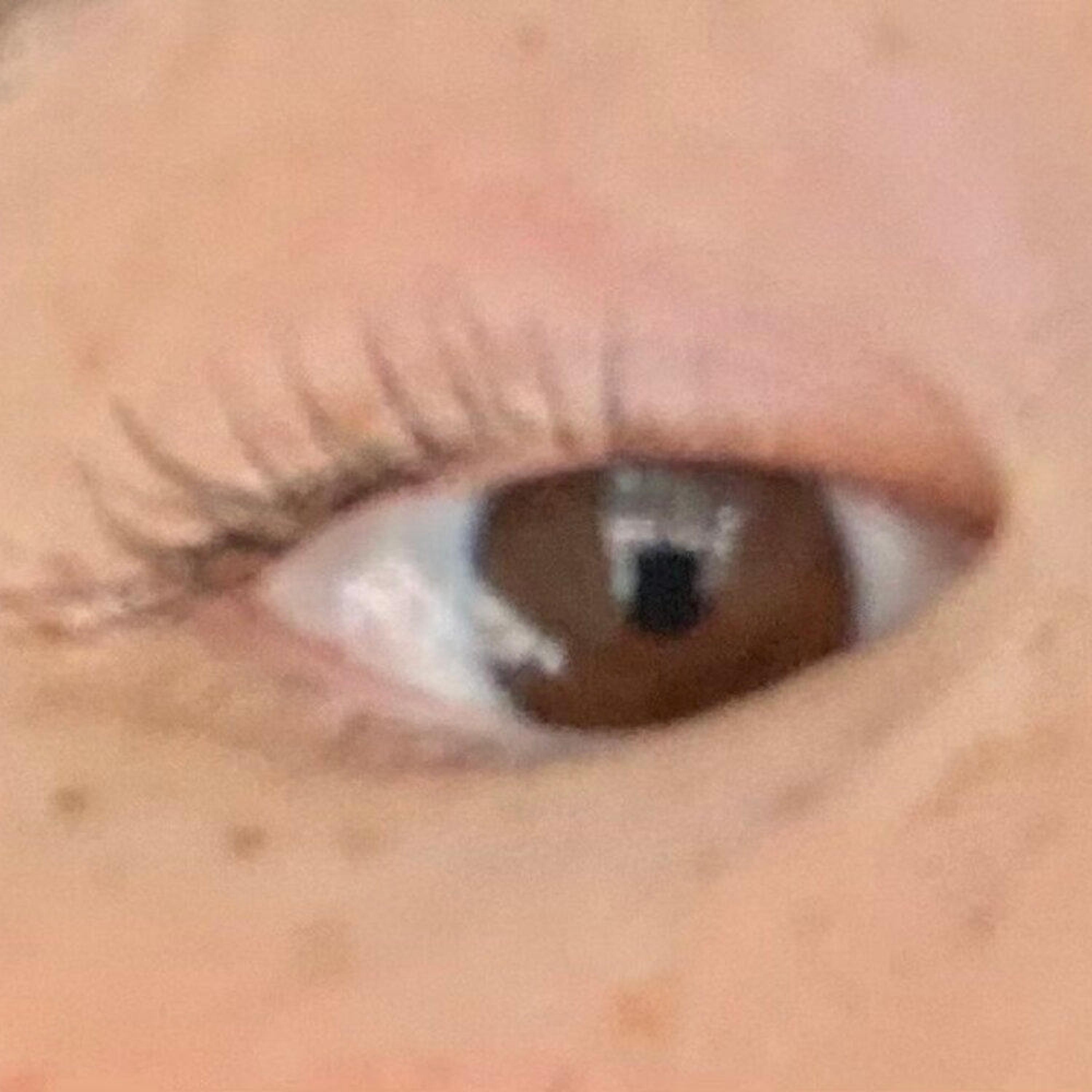 IN THE EYES