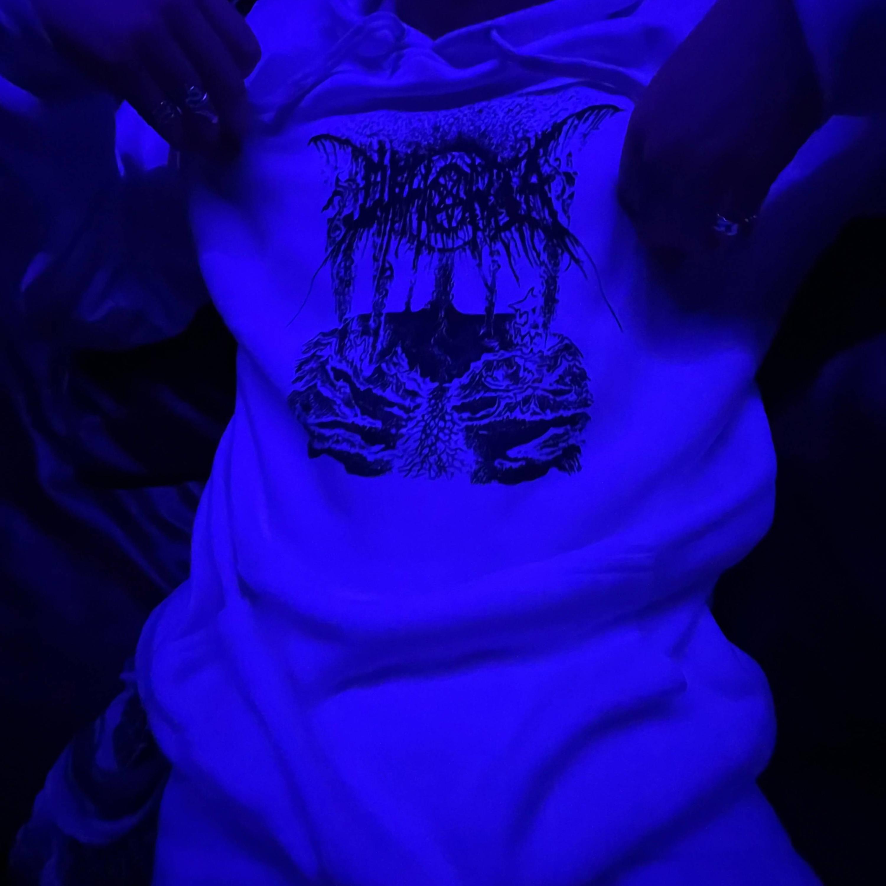 anxious (feat. Mixed Matches)