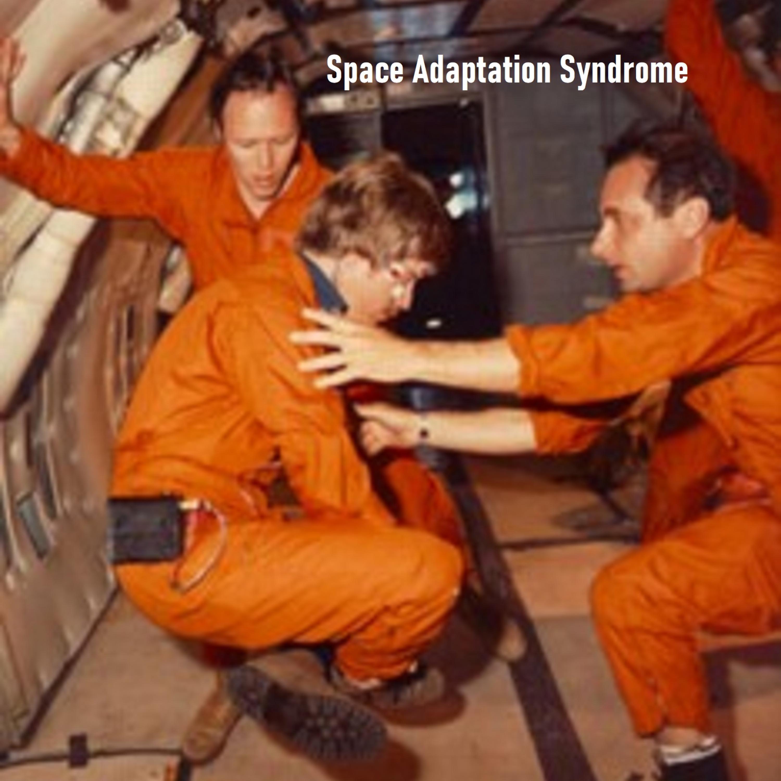 Space Adaptation Syndrome