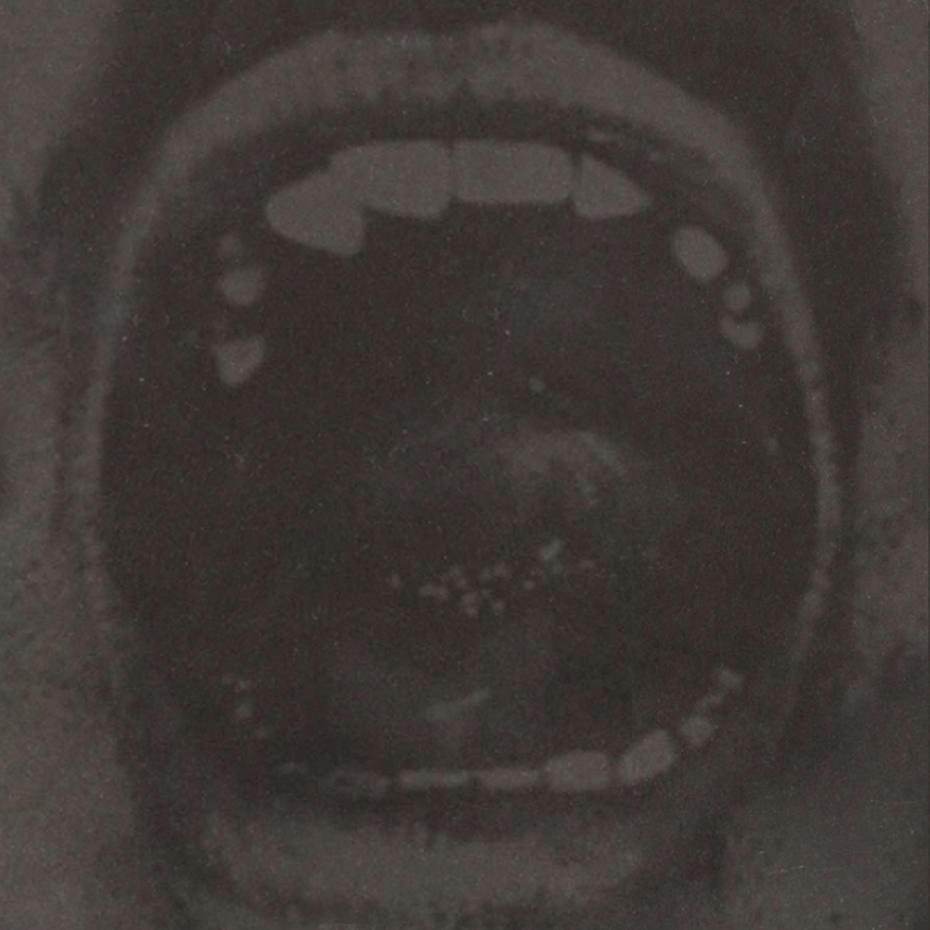 汚