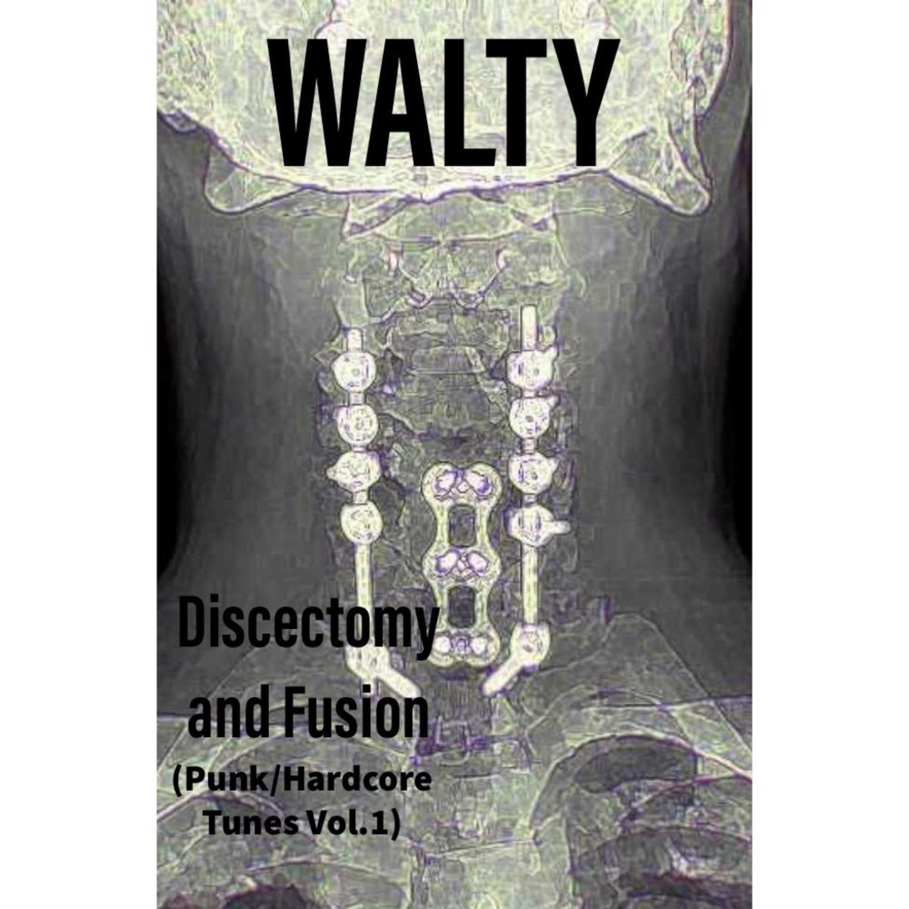 Walty - Superlativity