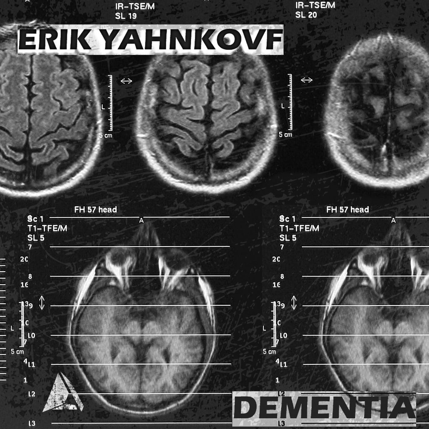 Dementia