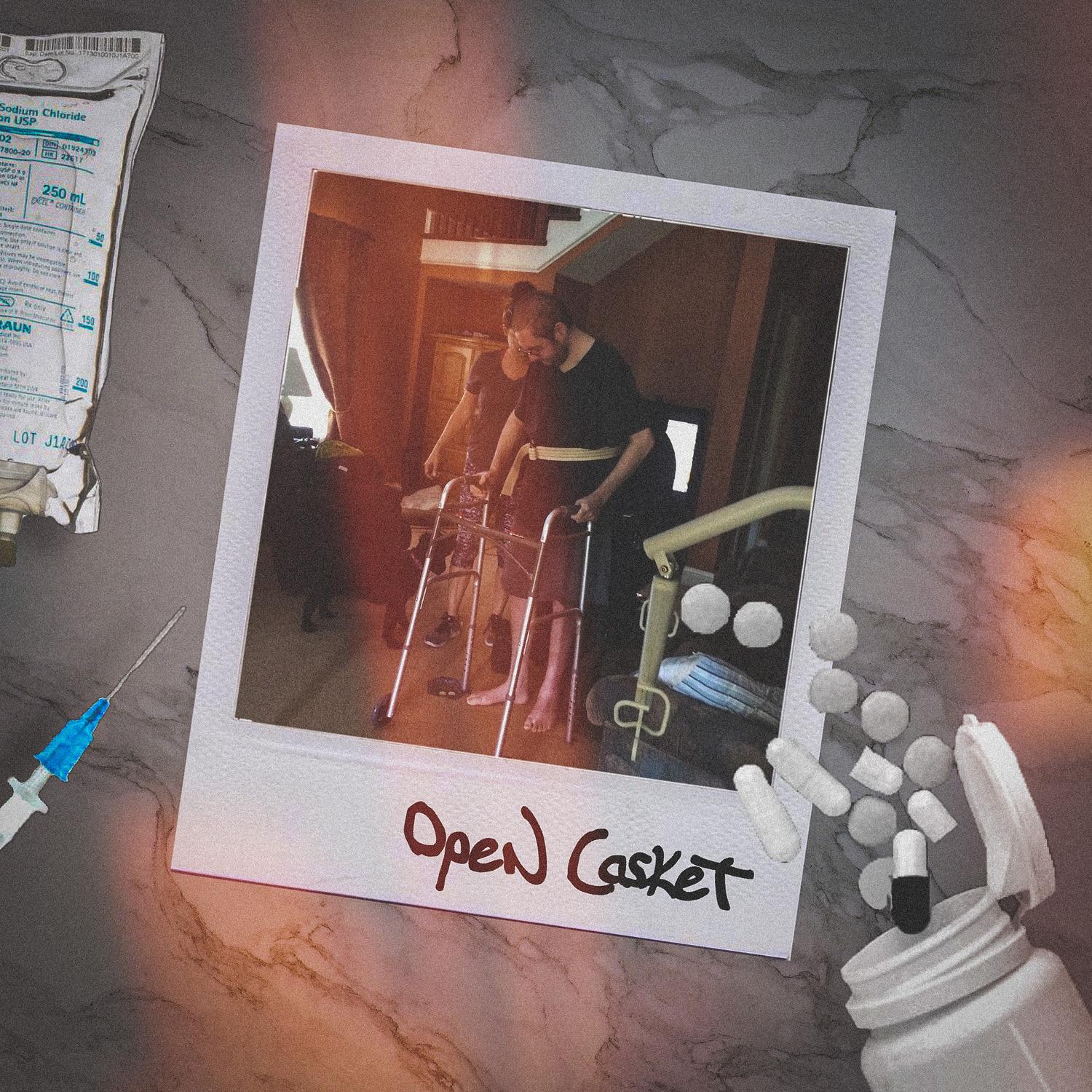 Open Casket