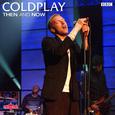 Coldplay: Then and Now (Live)