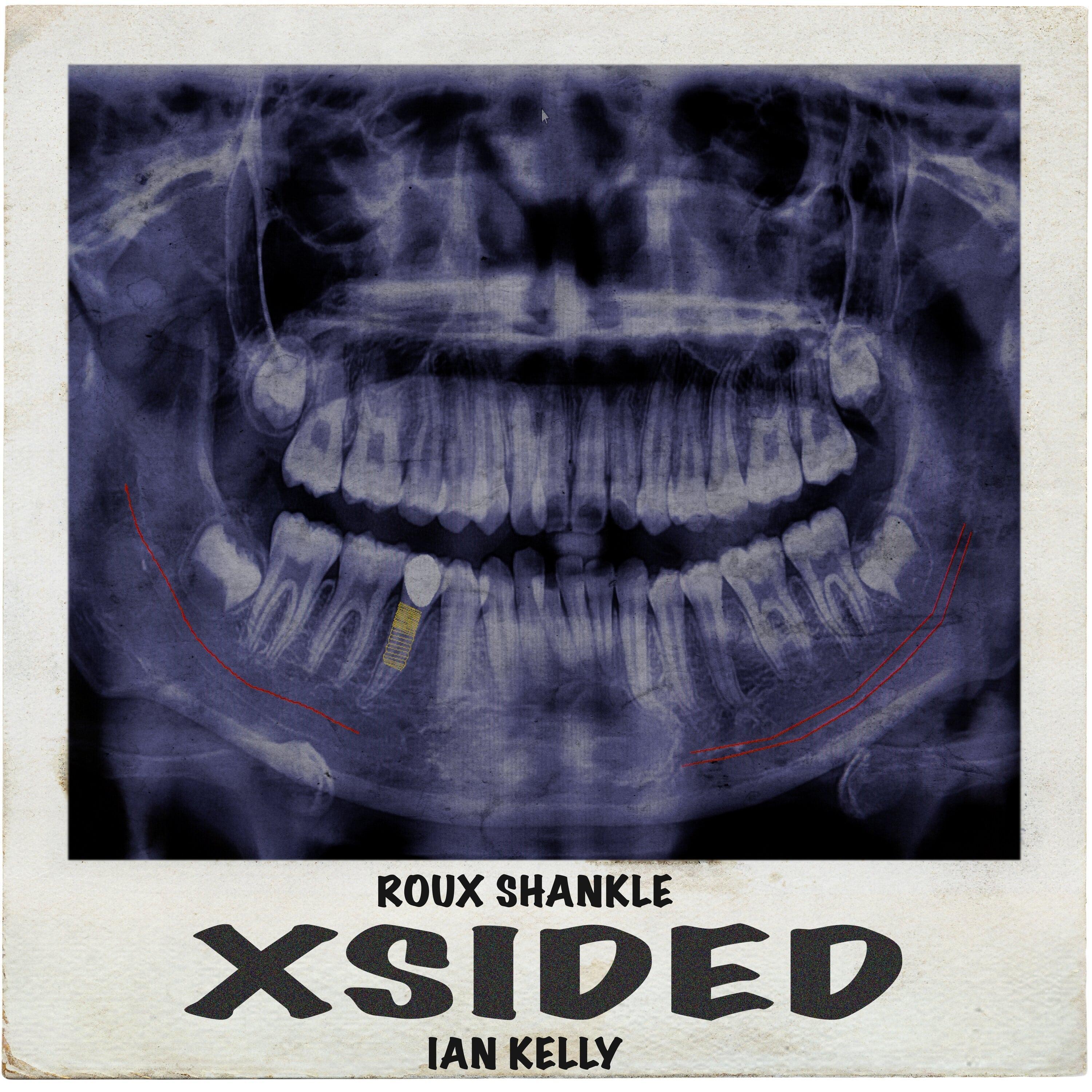XSIDED (feat. Ian Kelly)