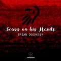 Scars On His Hands