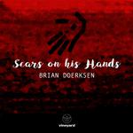 Scars On His Hands专辑