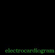 electrocardiogram