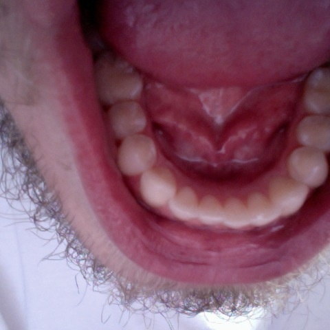 Milk Teeth Nightmare